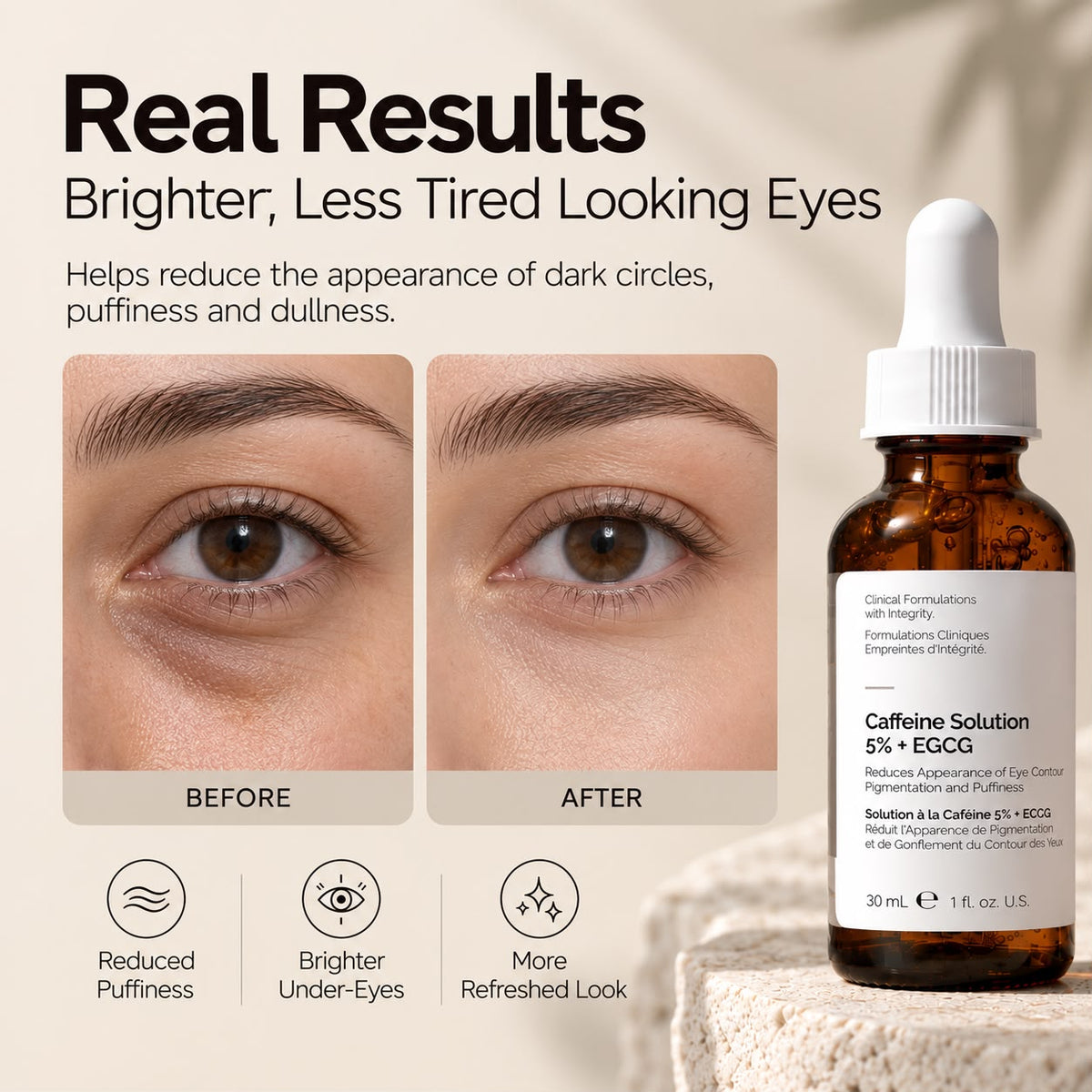 GlowEyes™ Dark Circle Renewal Serum